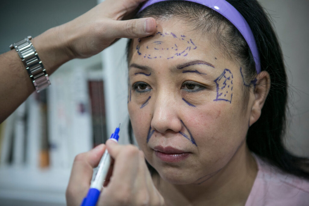 Facing Beauty: China’s plastic surgery addiction